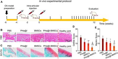 Icariin-Loaded Hydrogel Regulates Bone Marrow Mesenchymal Stem Cell Chondrogenic Differentiation and Promotes Cartilage Repair in Osteoarthritis